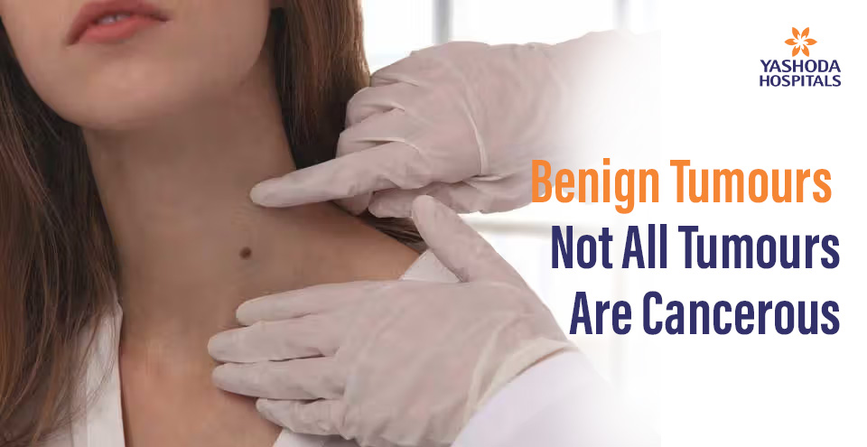 Benign Tumours-Not All Tumours Are Cancerous