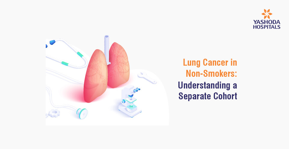 Lung Cancer in Non-Smokers: Understanding a Separate Cohort