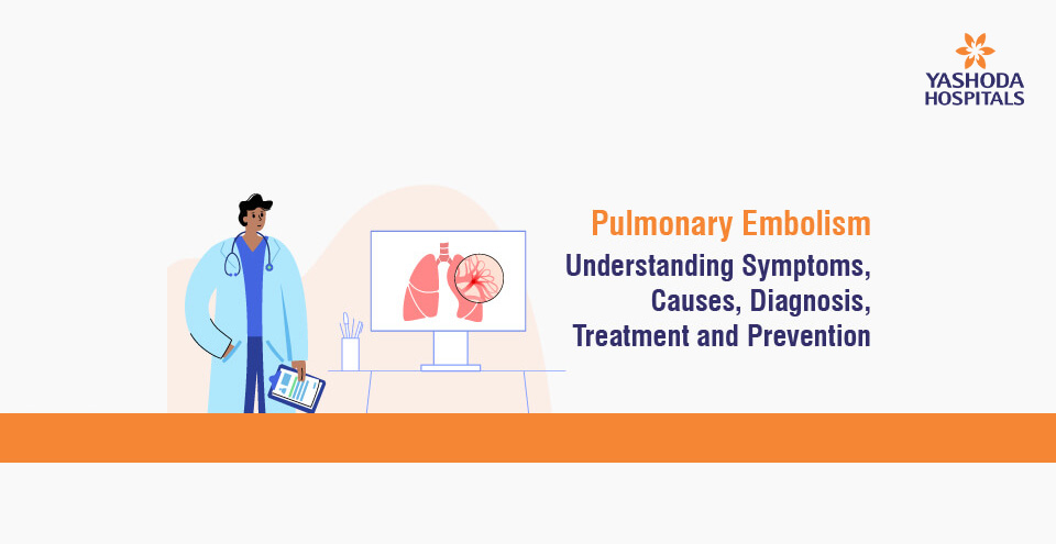 Pulmonary Embolism: Understanding Symptoms, Causes, Diagnosis, Treatment and Prevention