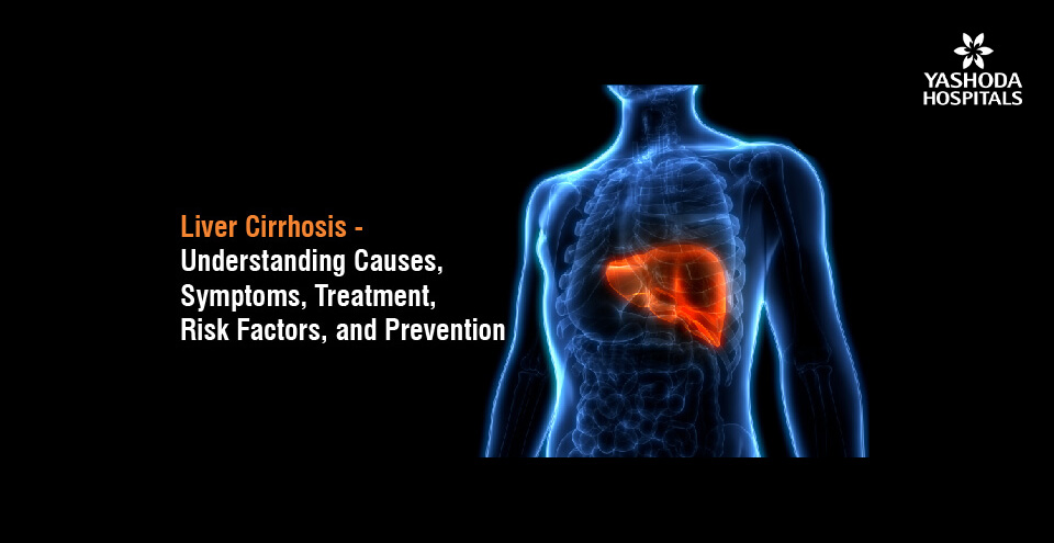 Liver Cirrhosis – Understanding Causes, Symptoms, Treatment, Risk Factors, and Prevention