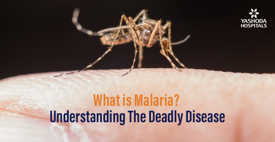 What is Malaria? Understanding The Deadly Disease