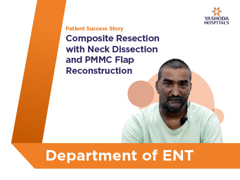 Composite Resection with Neck Dissection and PMMC Flap Reconstruction