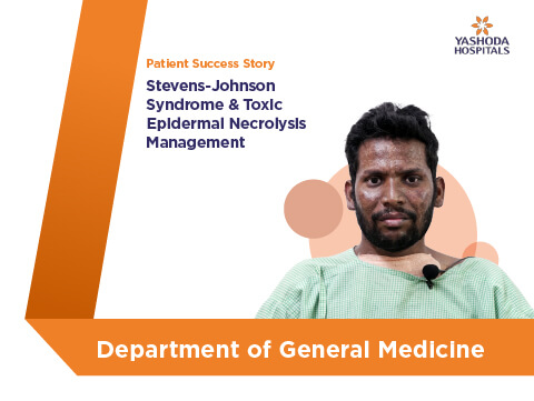 Stevens-Johnson Syndrome and Toxic Epidermal Necrolysis Management