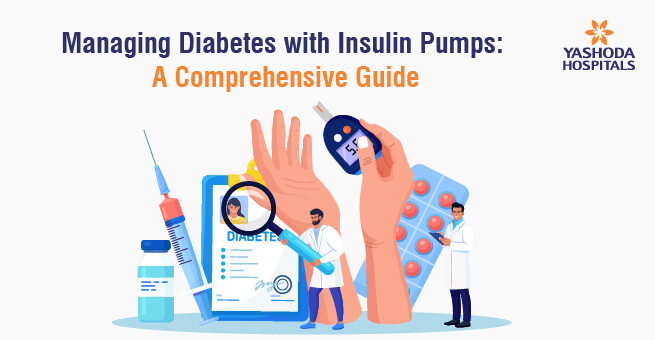 Managing Diabetes with Insulin Pumps