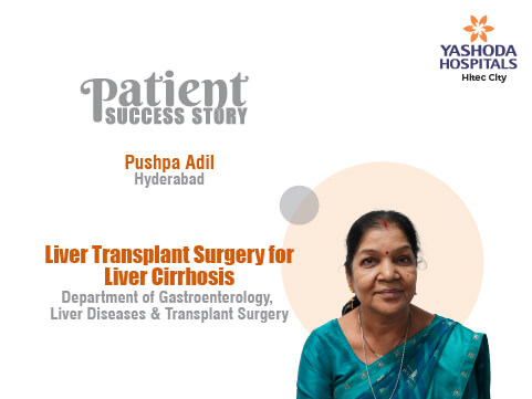 Liver Transplant Surgery for Liver Cirrhosis