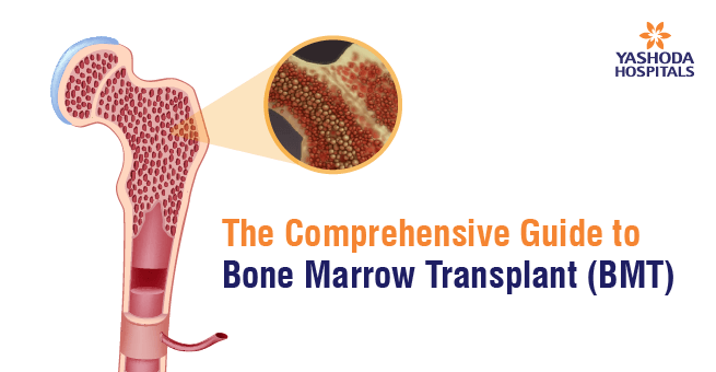 Bone Marrow Transplant Banner