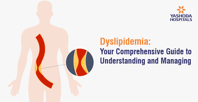 Dyslipidemia: Your Comprehensive Guide to Understanding and Managing