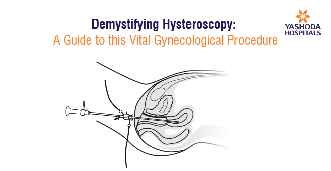 hysteroscopy-new-banner