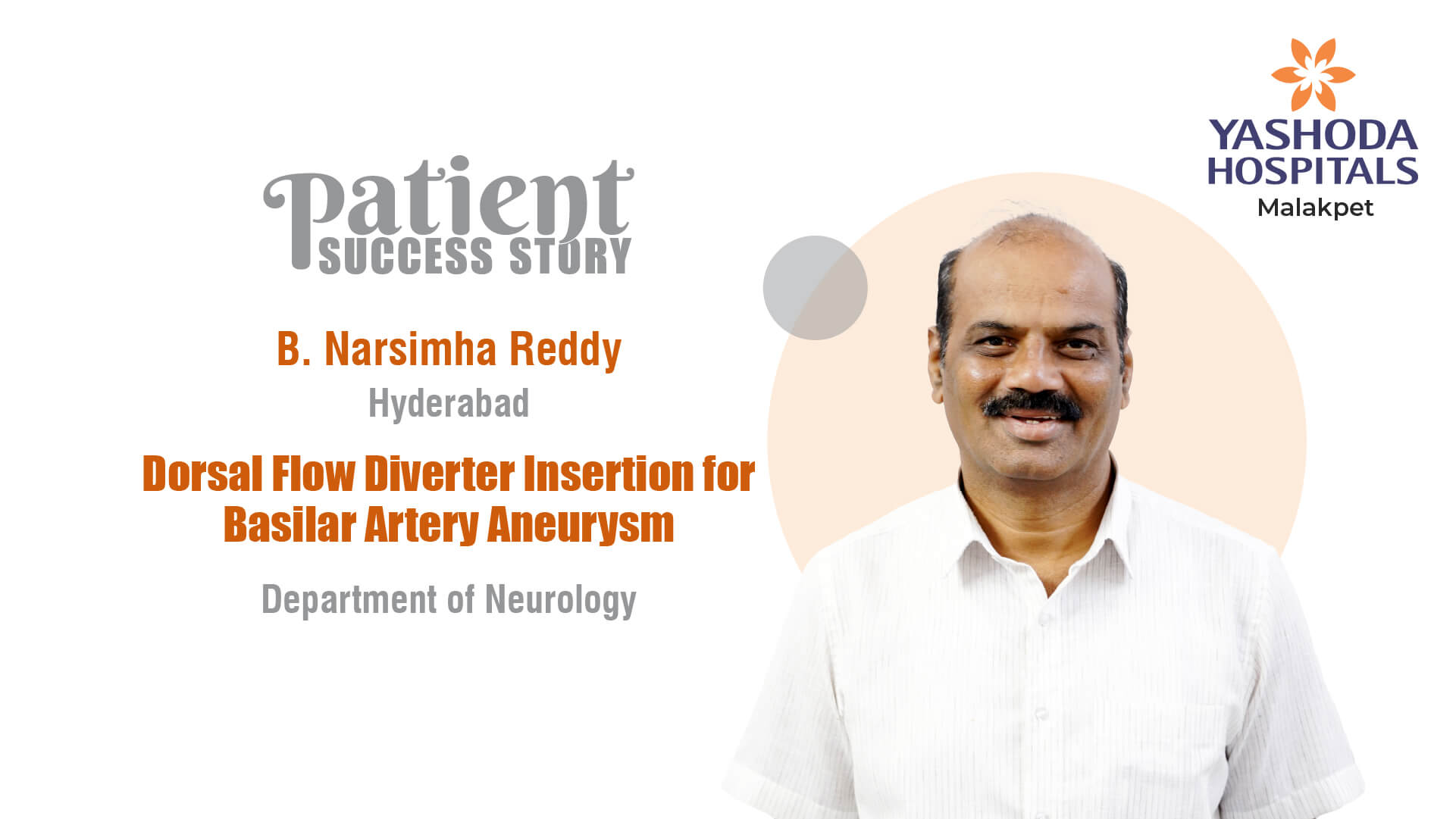 Dorsal Flow Diverter Insertion for Basilar Artery Aneurysm