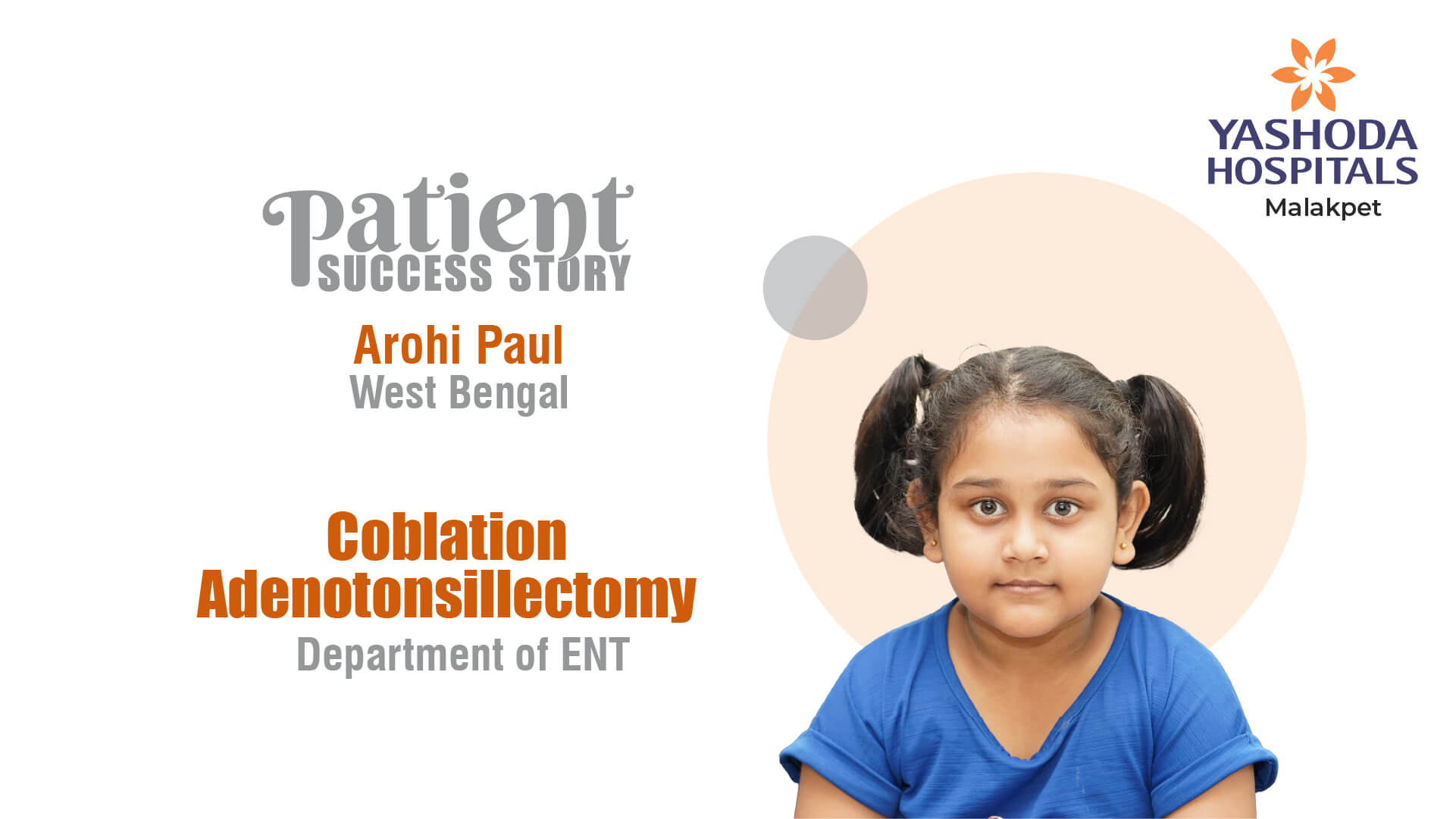 Coblation Adenotonsillectomy