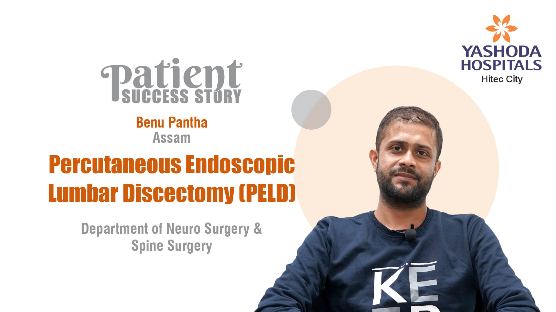 Percutaneous Endoscopic Lumbar Discectomy (PELD)