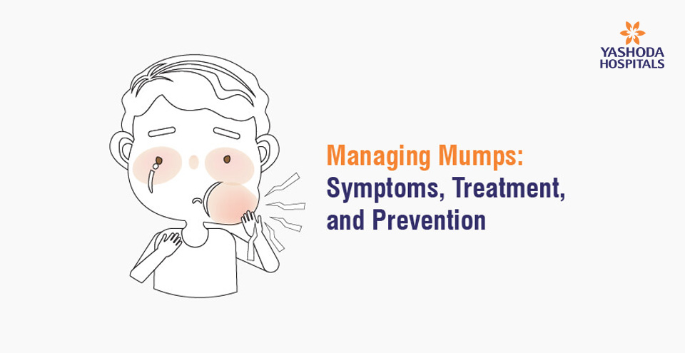 Managing Mumps: Symptoms, Treatment, and Prevention