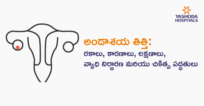 Ovarian Cyst: Types, Causes, Symptoms, Diagnosis, and Treatment (Telugu)